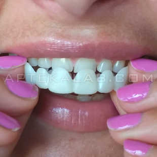 Perfect Smile Veneers в аптеке